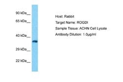 ROGDI Rabbit anti-Human, Polyclonal, Novus Biologicals 0.1ml; Unconjugated:Antibodies,